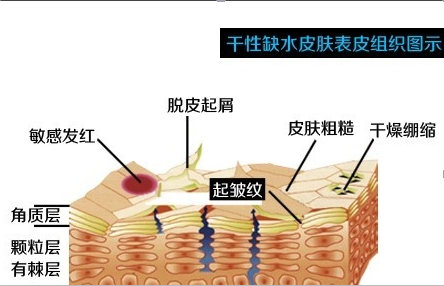 干燥缺水皮肤表皮组织图示